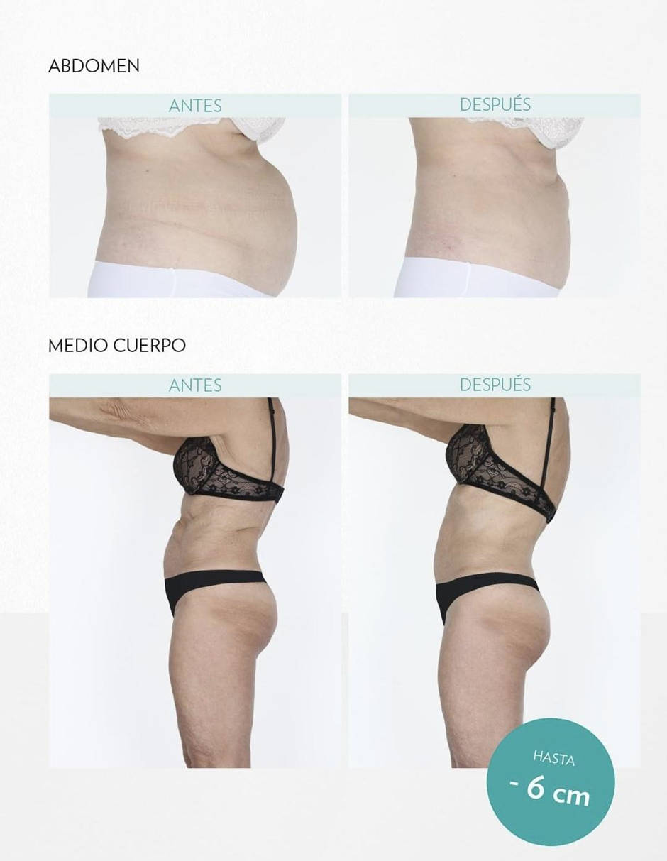 img-tratamientos-corporales-03